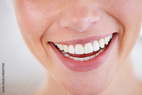 Smile a while. Close up of a woman s sparkling teeth.