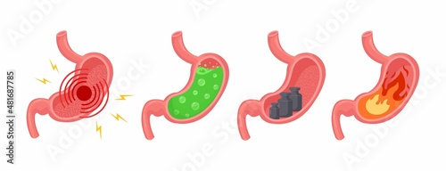 Diseases of stomach. Medical vector illustration set. Stomach pain, gastritis, indigestion, vomiting, heartburn. Pyrosis fire disorder, gastric acid reflux, Abdominal bloated ball, green liquid nausea