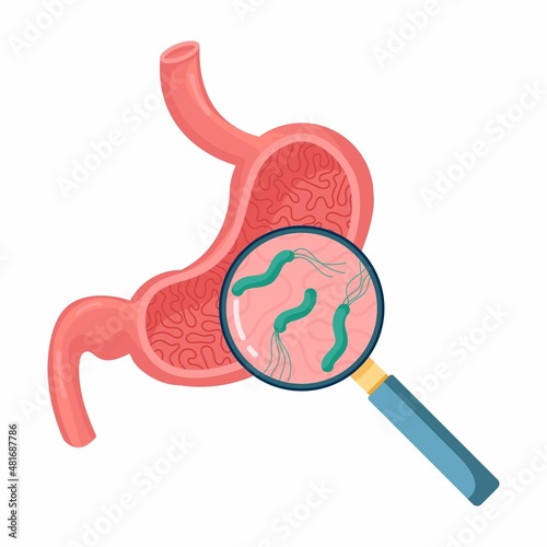 Helicobacter Pylori in the stomach. Stomach diseases. Bacterium with flagella that causes gastritis. Bacteria under magnifying glass. Vector illustration on white background