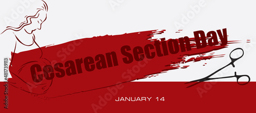 Card Cesarean Section Day