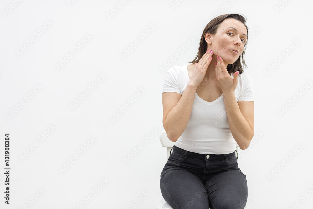 Photo of woman with dry skin touching her face on white background. Photo of woman with dry skin touching her face on white background.