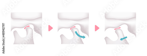 Structural illustration when opening and closing the jaw (no text )