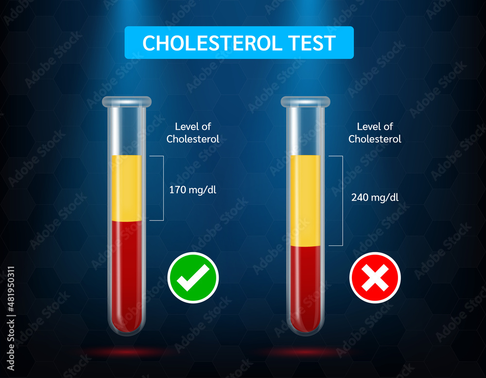 Medical blood test cholesterol in test tube. cholesterol meter scale