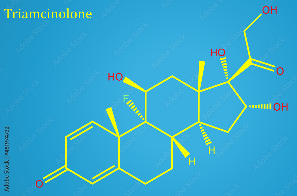 Triamcinolone Is A Glucocorticoid Used To Treat Certain Skin Diseases Allergies And Rheumatic Disorders Among Others It Is Also Used To Prevent Worsening Of Asthma And Copd Stock イラスト Adobe Stock