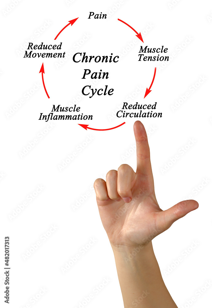 Steps in Chronic Pain Cycle Steps in Chronic Pain Cycle