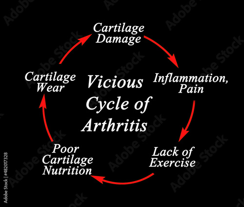 Steps in  Vicious Cycle of Arthritis