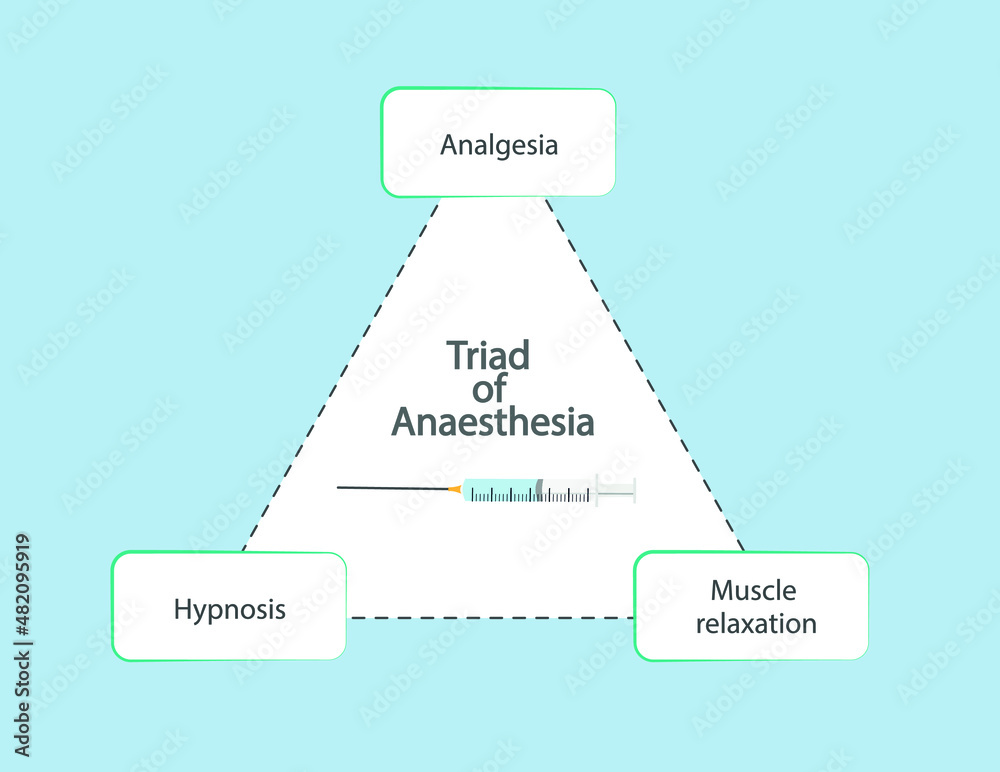 Triad of Anaesthesia. General anaesthesia 3 pilars. Analgesia, Hypnosis