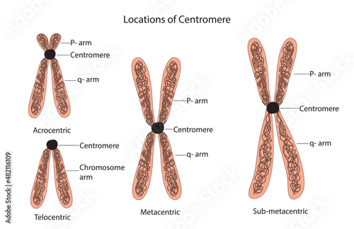 Locations of Centromere in the chromosome (metacentric, submetacentric, acrocentric, and telocentric) photo