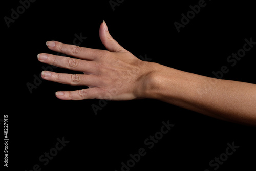 Female wrist Rheumatoid Arthritis photo