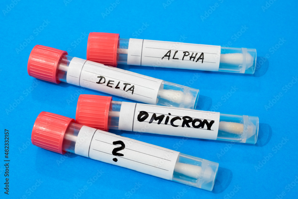 Swab tubes with medical samples on blue background Swab tubes with medical samples on blue background