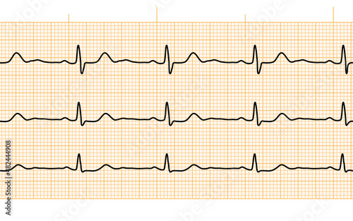 Heart beat ecg or ekg seamless black line on orange paper. Electrocardiogram graph of healsh cardio rate. Examination of human health. Medicine test cardiac rhythm and pulsating inteval.