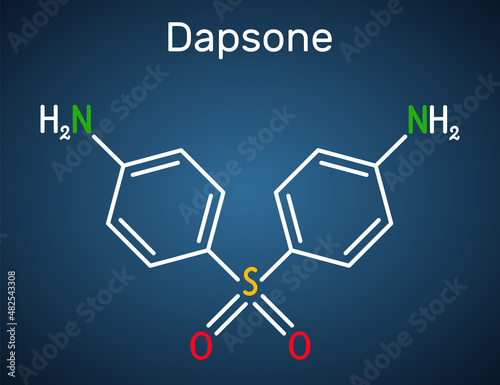Dapsone, diaminodiphenyl sulfone, DDS molecule. It is sulfone antibiotic for the treatment of leprosy and dermatitis herpetiformis. Structural chemical formula on the dark blue background photo