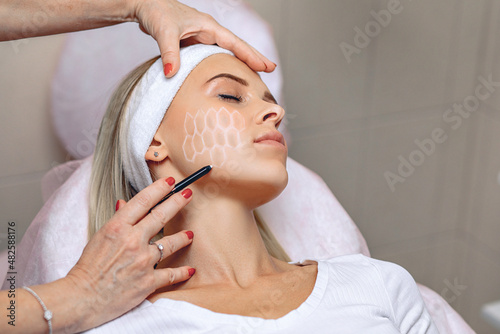 Attractive pretty client drawing a grid with a white pencil for further acupuncture procedure. Beauty procedures concept