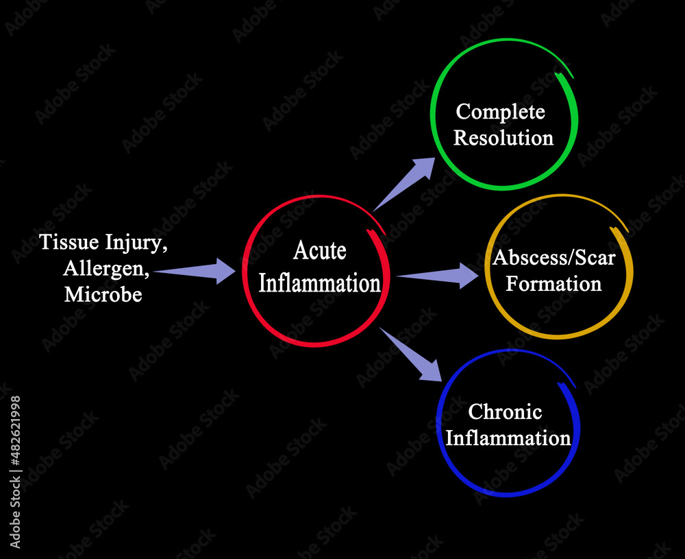 Three ways of resolution of acute inflamation