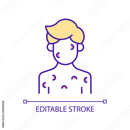 Skin disorder RGB color icon. Sign and symptom of disease. Dermatological illness. Rash treatment. Isolated vector illustration. Simple filled line drawing. Editable stroke. Arial font used