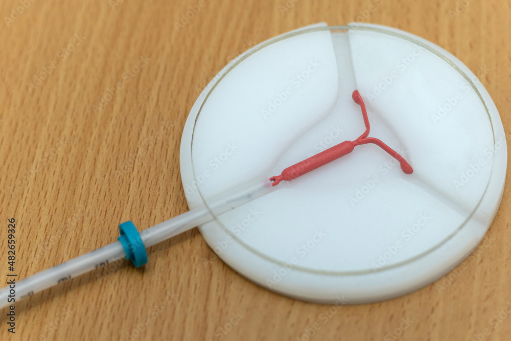 Copper coil device for birth control (DUI). Birth control and gynecology concept. Copper coil device for birth control (DUI). Birth control and gynecology concept.