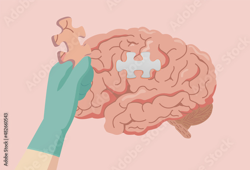 Doctor's hand with gloves holding the jigsaw of brain for add it on space of the puzzle. Concept illustration about dementia and Alzheimer's disease treatment. photo