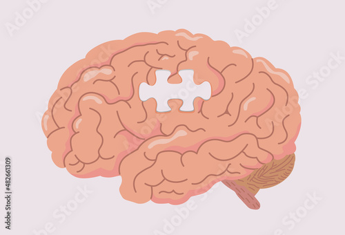 Human brain with space in shape like a jigsaw of the puzzle. Illustration about dementia and Alzheimer's disease and losing memory.