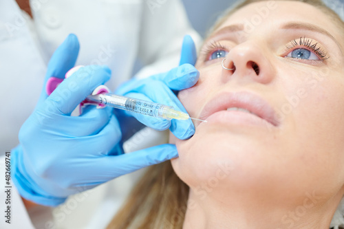 botox labios