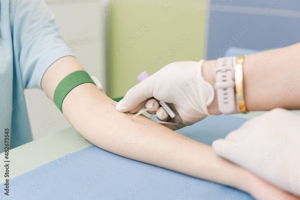 Obraz premium Taking a blood test from a vein in the treatment room. Nurse pricking a syringe with a needle into the patient hand. Swab pressed against the injection site during blood donation. Tube with blood