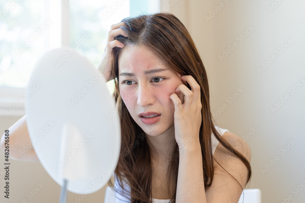Dermatology, puberty asian young woman, girl looking into mirror, allergy presenting an allergic reaction from cosmetic, red spot or rash on face. Beauty care from skin problem by medical treatment. Dermatology, puberty asian young woman, girl looking into mirror, allergy presenting an allergic reaction from cosmetic, red spot or rash on face. Beauty care from skin problem by medical treatment.