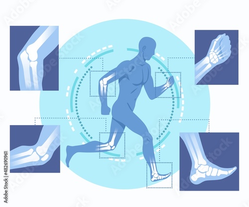 Concept of orthopedic technology. Running man with X ray interface. Treatment of broken bones and damaged ligaments. Innovations in medical examination. Cartoon modern flat vector illustration