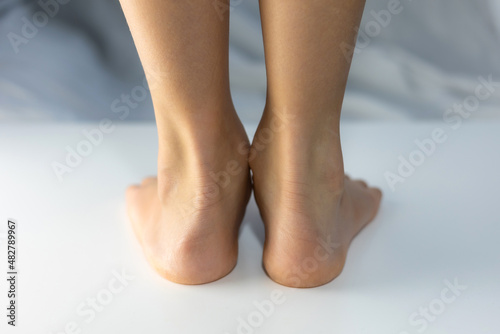 Boy's feet with flat feet or fallen arch, ankle lean inward causing leg length difference. Showing abnormal shapes  flat and normal foot. photo