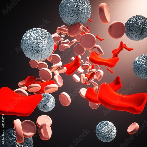 Thalassemia, illustration