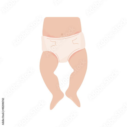 baby with diaper rash. Redness of the skin in the groin and abdomen. Allergy to sorbent, irritation. Dermatological problems. Isolated image on a white background. Vector illustration, flat