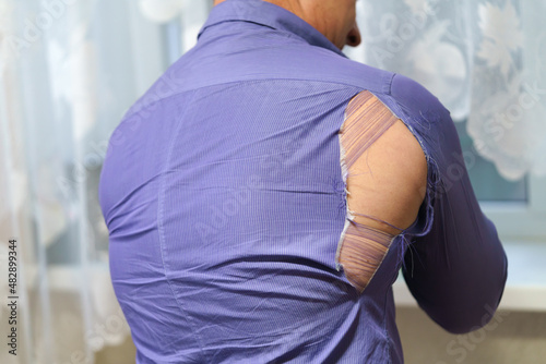 a hole on a purple man's shirt. Strong man rips purple shirt