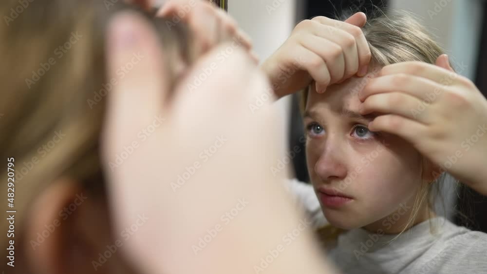 Young teenager girl squeezing acnes on skin face front mirror. Portrait of a teenager with problem skin. Girl teenager squeezes pimples on her face. Youth skin care. Young teenager girl squeezing acnes on skin face front mirror. Portrait of a teenager with problem skin. Girl teenager squeezes pimples on her face. Youth skin care.