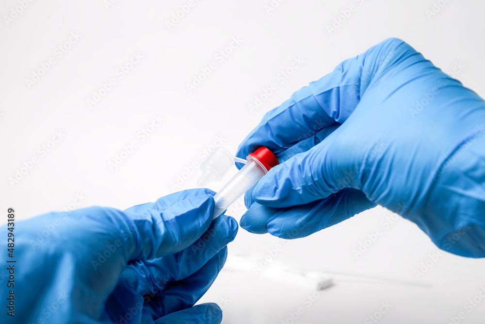 Man makes a covid-19 antigen pcr test macro. The test showed a positive result. Man makes a covid-19 antigen pcr test macro. The test showed a positive result.