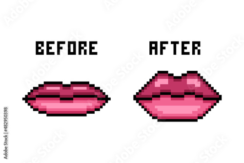 Pixel art natural thin vs full filler injection lips, before and after cosmetic procedure difference. Plastic surgery result. 8 bit sexy woman mouth icon isolated on white.Hyaluronic acid augmentation