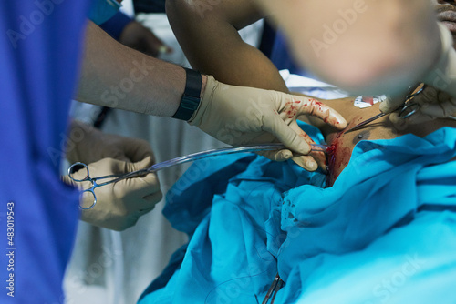 Intubating his patient's chest. Cropped shot of a doctor inserting a tube into a patients chest in an emergency room.