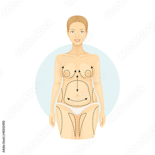 Cosmetic surgery on female body with dotted lines. Plastic surgery vector illustration