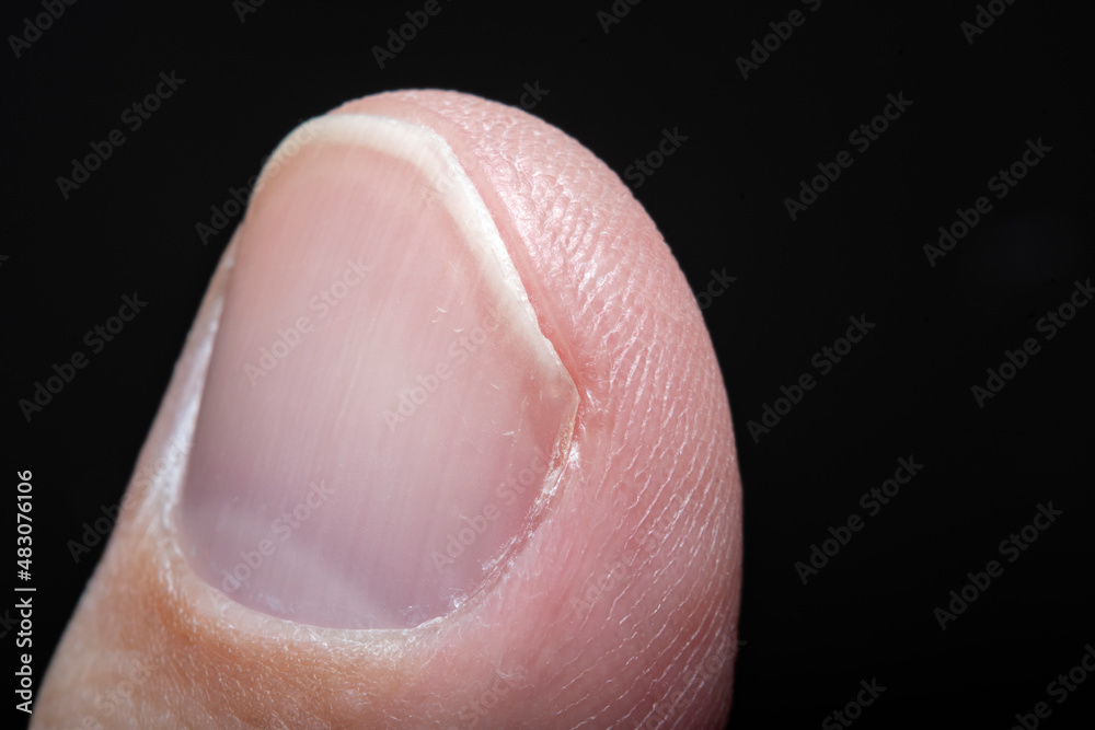 Fototapeta premium Close-up of male fingertips with nails. Photo in soft focus at high magnification.