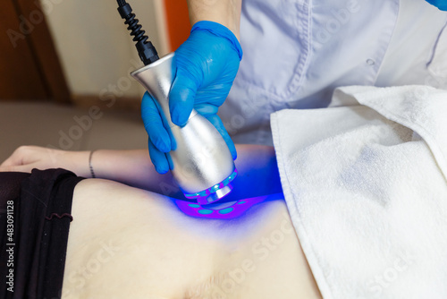 Cryotherapy for body shaping. Hardware cosmetology of the body.