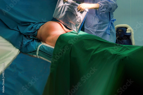 Caesarean section, Scrub nurse preparing the abdomen, cleaning and laying the sterile cloth for the caesarean section. Patient preparation for surgery. New born baby, mom's abdomen - Concept Genesis. photo