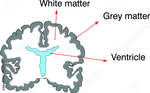 brain cross section