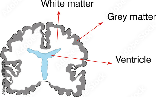 brain cross section