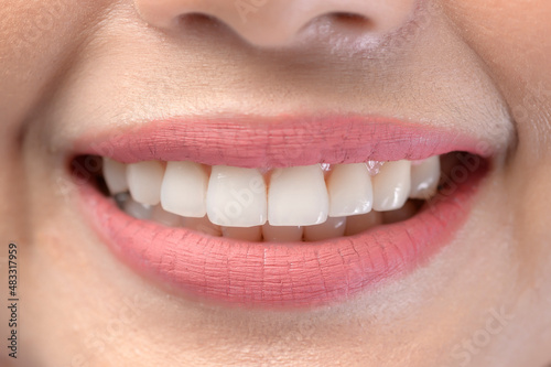 Close up of white healthy teeth of beautiful smile young woman
