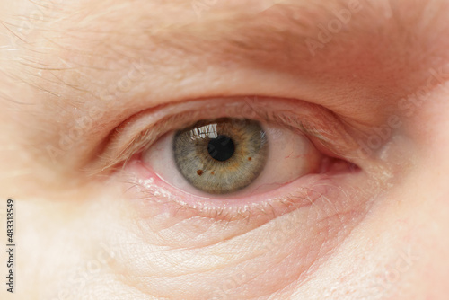 Right eye of a white male close-up, soft focus. The human eye with a green-gray pupil