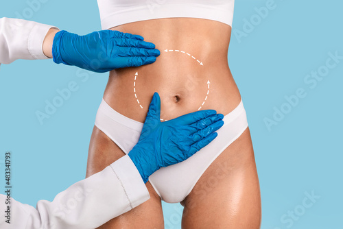 Obraz na plátně Woman having lipolysis treatment at beauty salon