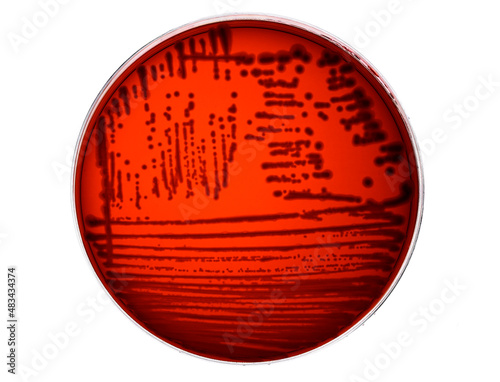 Microbial culture plate of the bacterium Enterobacter cloacae, a pathogenic enterobacterium photo