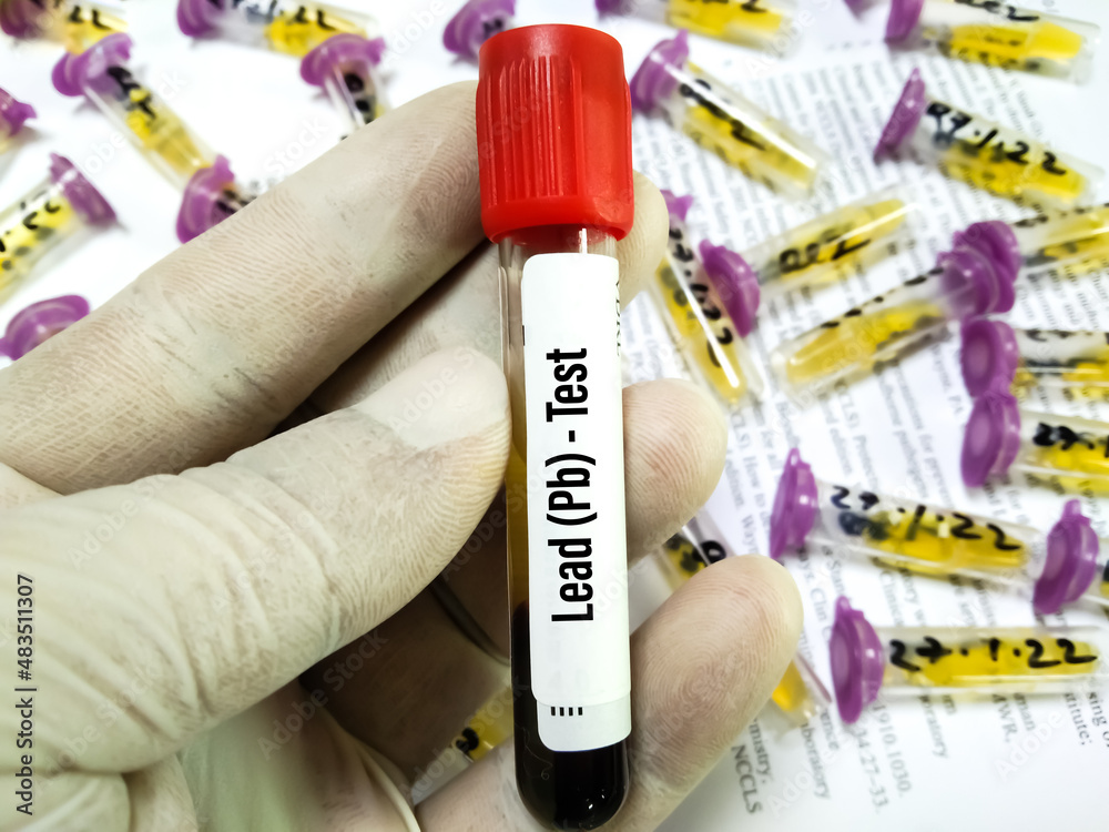 Blood sample tube for Lead (Pb) test at medical laboratory. To