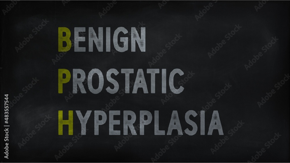 BENIGN PRO STATIC HYPERPLANE (BPH) on chalk board
BENIGN PRO STATIC HYPERPLANE (BPH) on chalk board