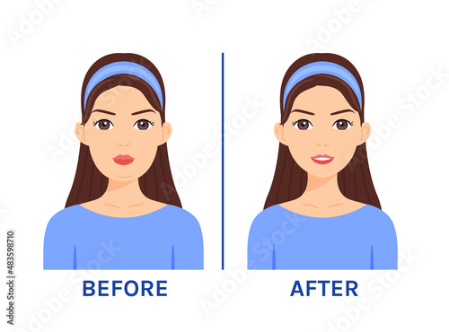 Beautiful Woman with Fat Face. Overweight and Double Chin. Treatment and Surgery. Before After. Happy Slim Lady. Smile on Female Face. Cartoon style. Vector illustration for Medical and Beauty design.