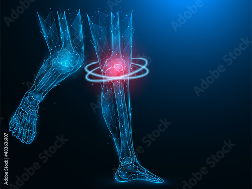 Polygonal vector illustration of human legs, painful and inflamed knee. Sick knee recovery concept. Treatment of knee arthritis. Futuristic medical banner, template or background.