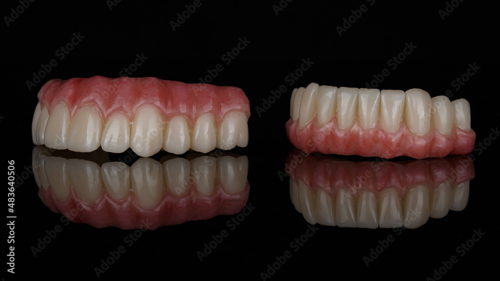 two prostheses for the upper and lower jaw with artificial gums on a black background with