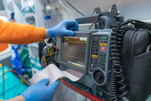 photo of a defibrillator monitor printing an electrocardiogram while hands with surgical gloves take the paper. stock photography photo